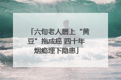 六旬老人唇上“黄豆”拖成癌 四十年烟瘾埋下隐患